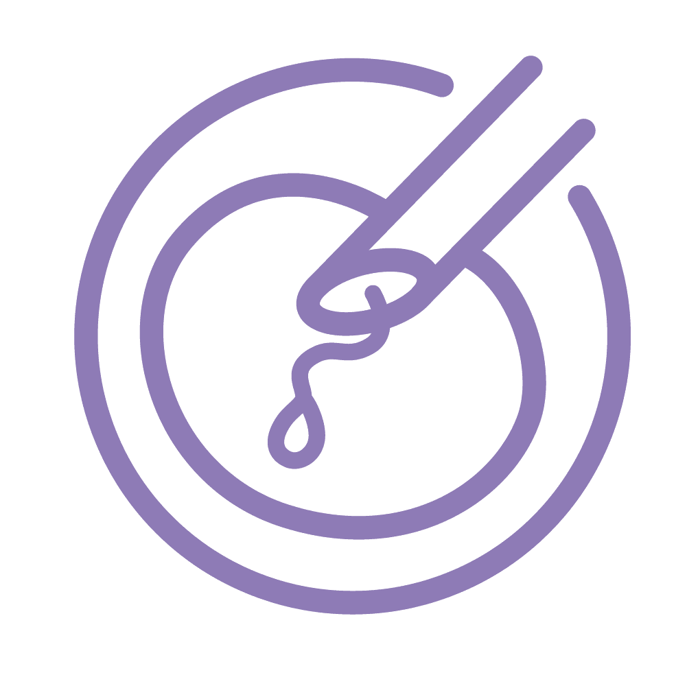 Natural Cycle IVF