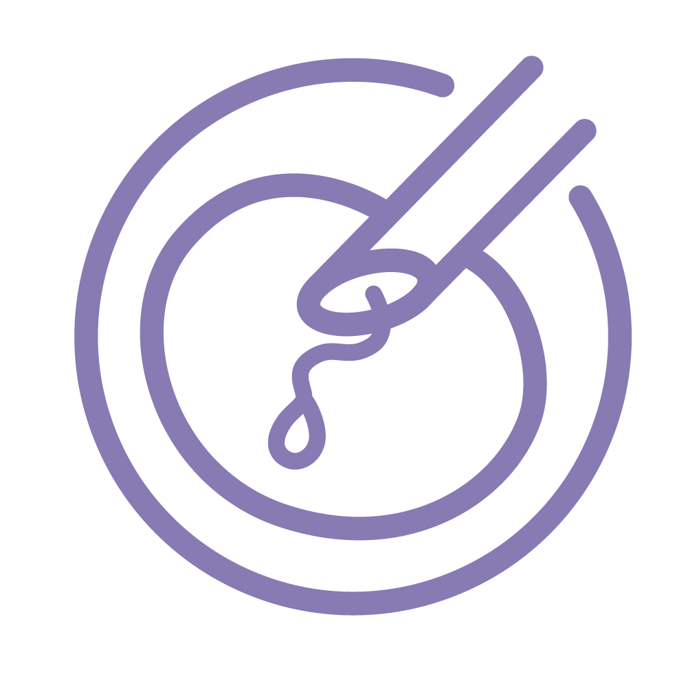 Natural Cycle IVF