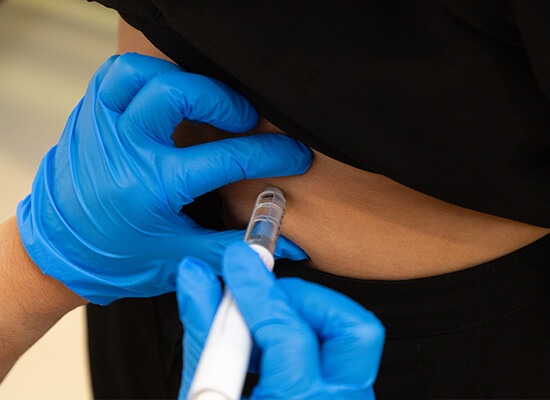 Estimulación ovárica FIV