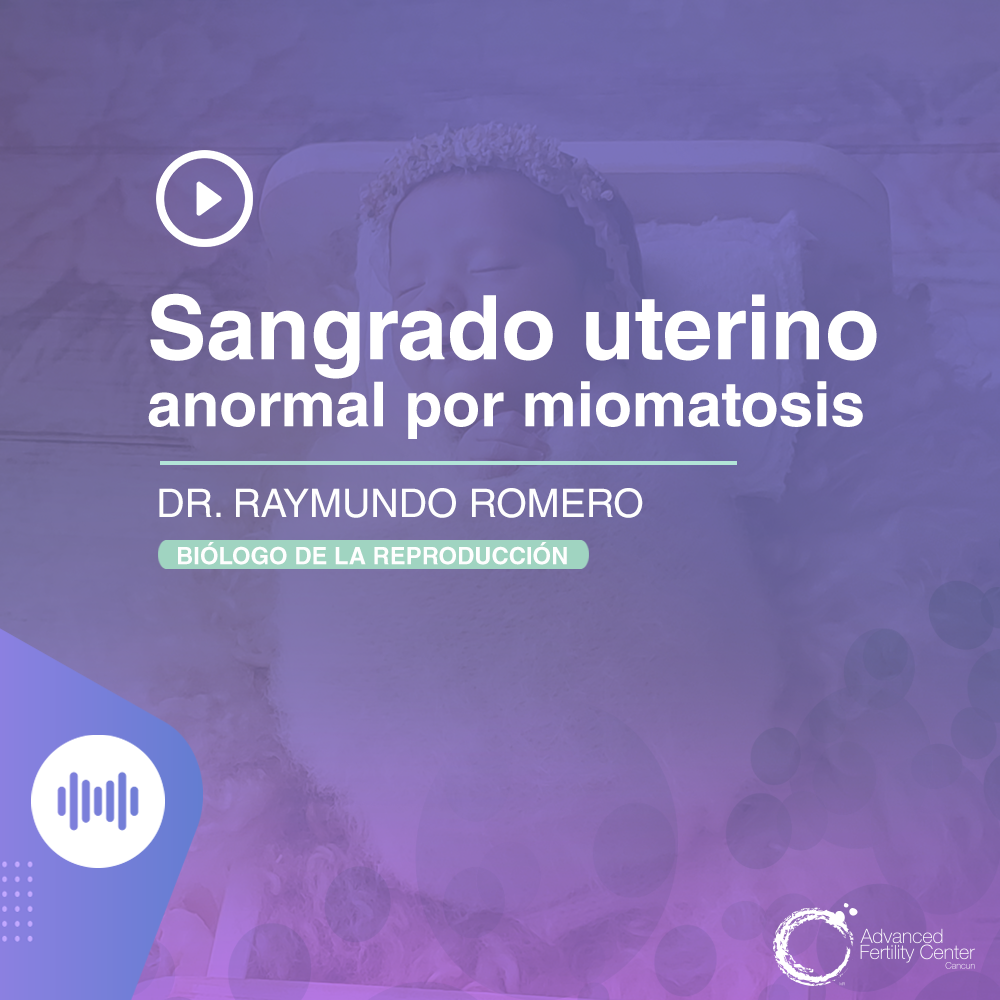 Sangrado uterino anormal por miomatosis